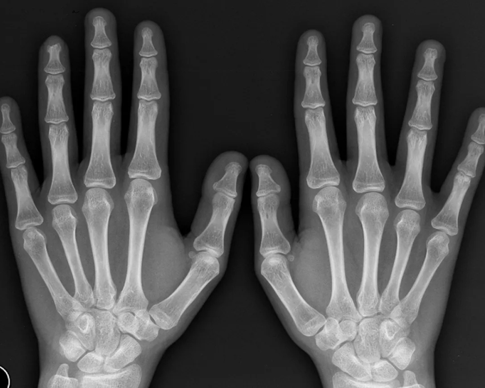 Aplicativos de Raio X Grátis